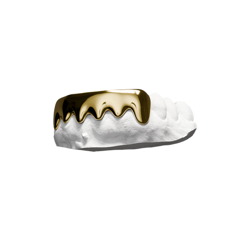 Grillz Blok – six dents recouvertes d'un bloc continu, effet drip or, vue 3/4