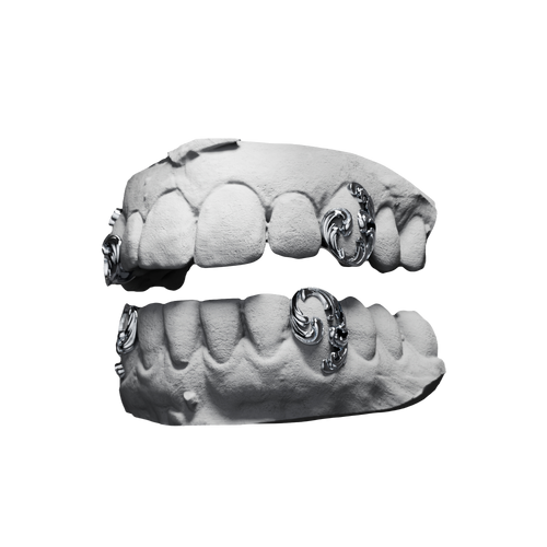 Grillz Canines Arabesques – canines ciselées en motif arabesques, argent, vue 3/4