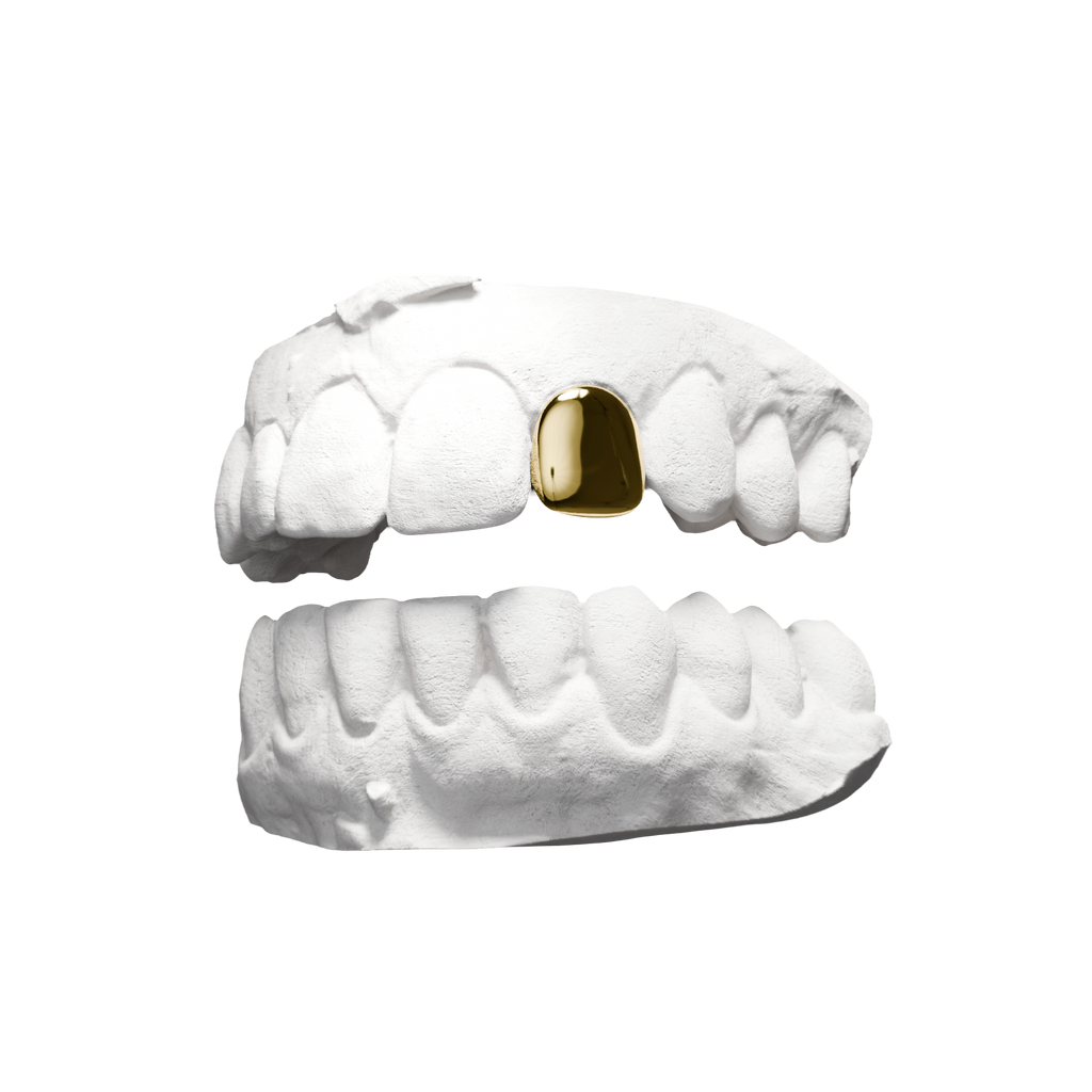 Grillz Dent Pleine – une dent entièrement recouverte, or, vue 3/4