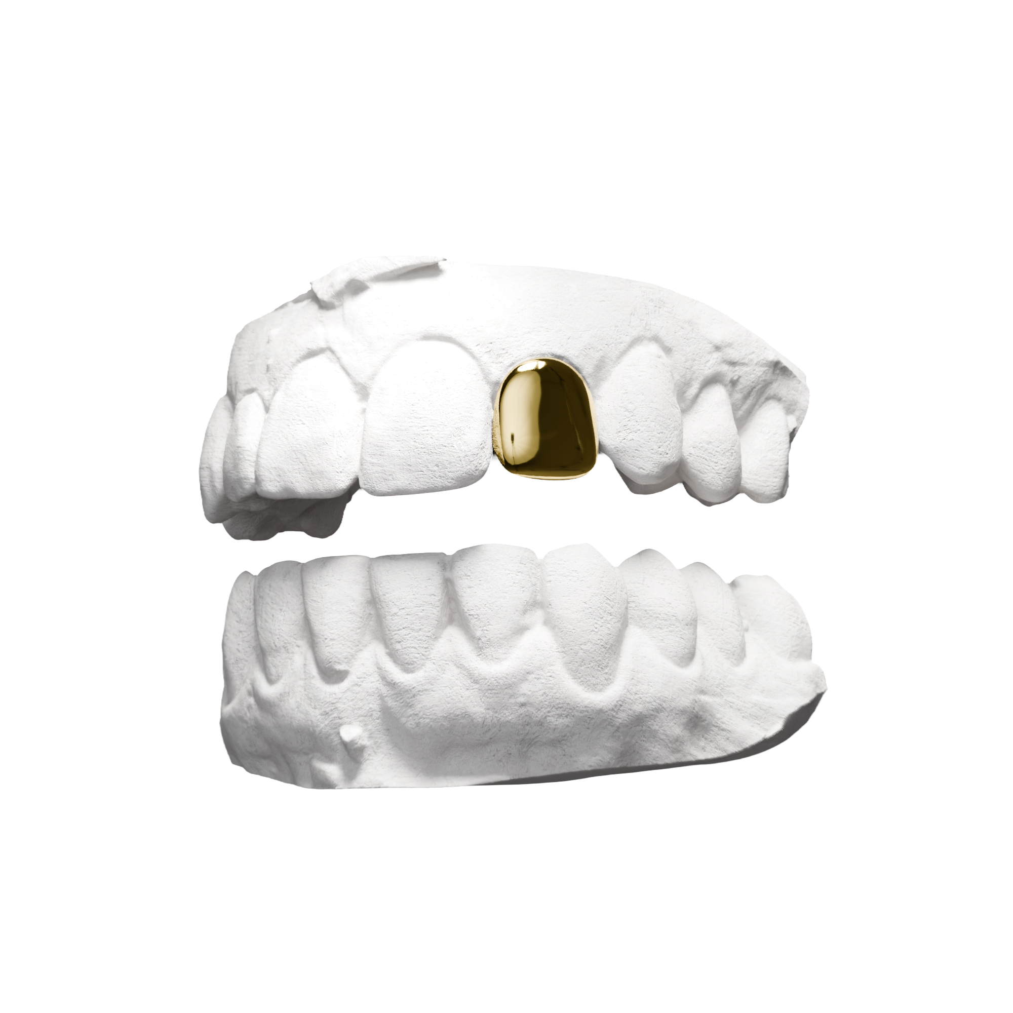 Grillz Dent Pleine – une dent entièrement recouverte, or, vue 3/4