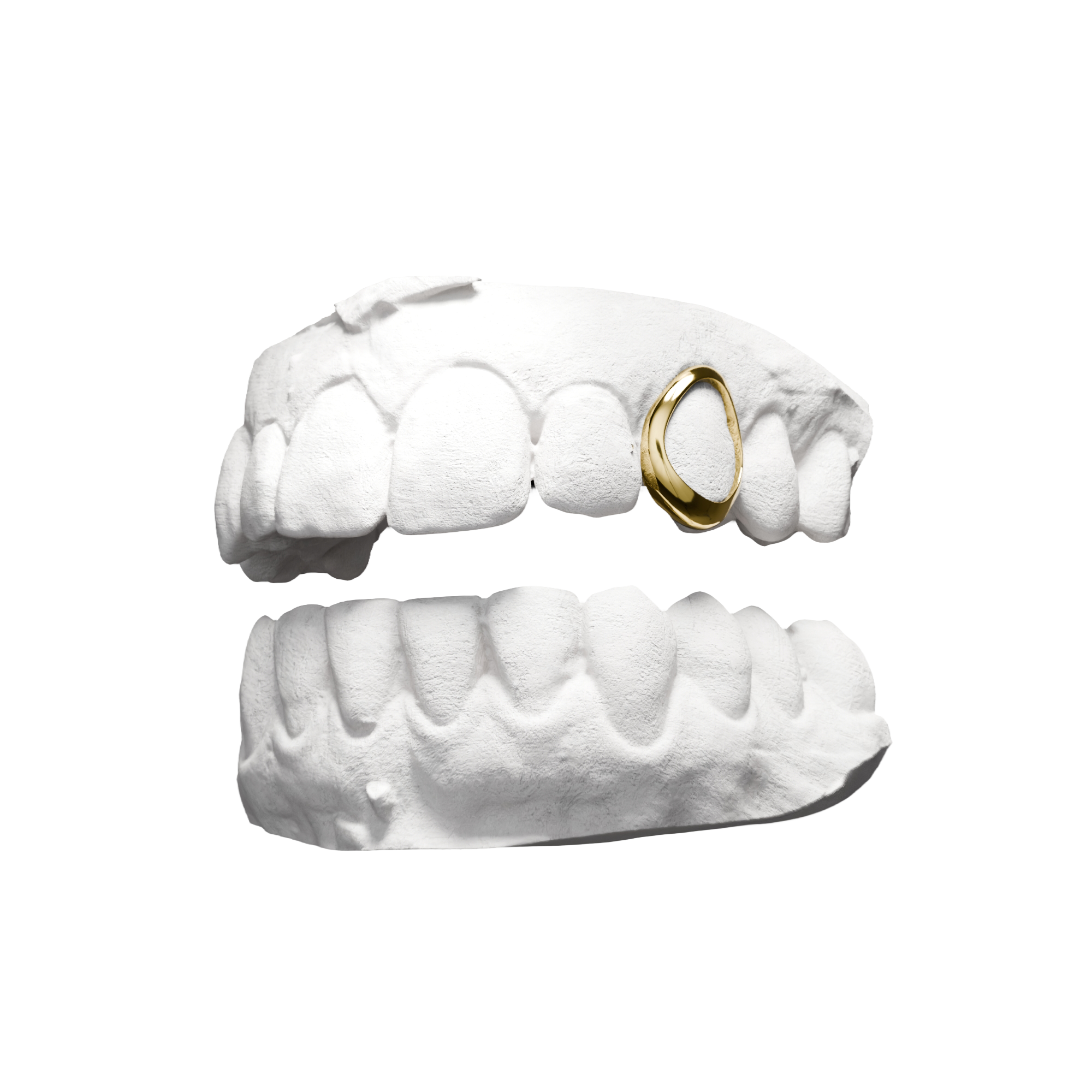 Grillz Fenêtre – contour métallique autour de la dent, or, vue 3/4