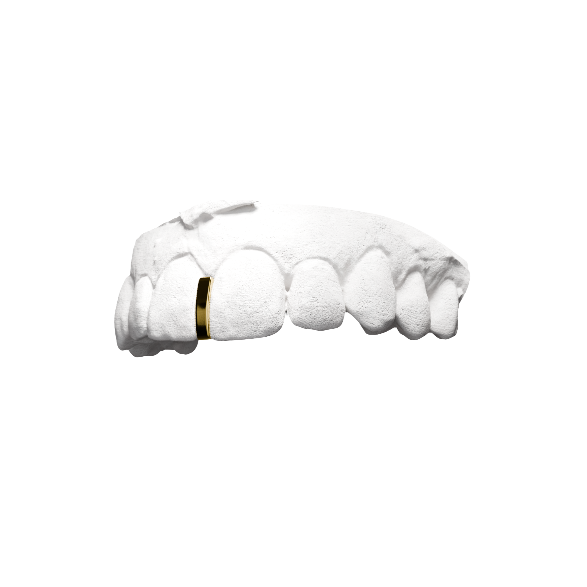 Grillz Interstice – barre entre deux dents, minimaliste or, vue 3/4