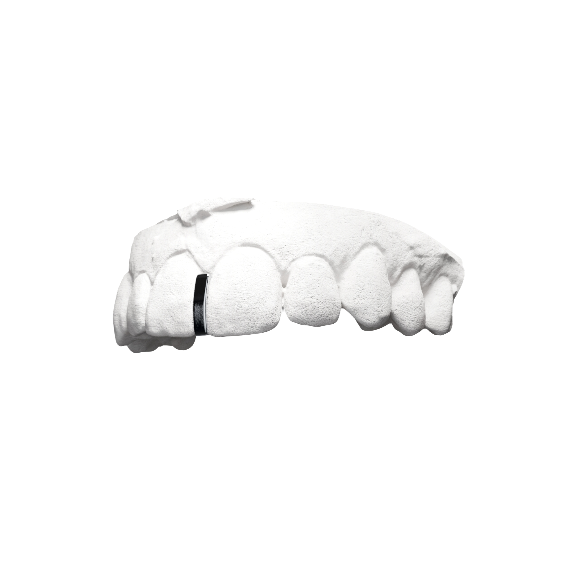 Grillz Interstice – barre entre deux dents, minimaliste argent, vue 3/4