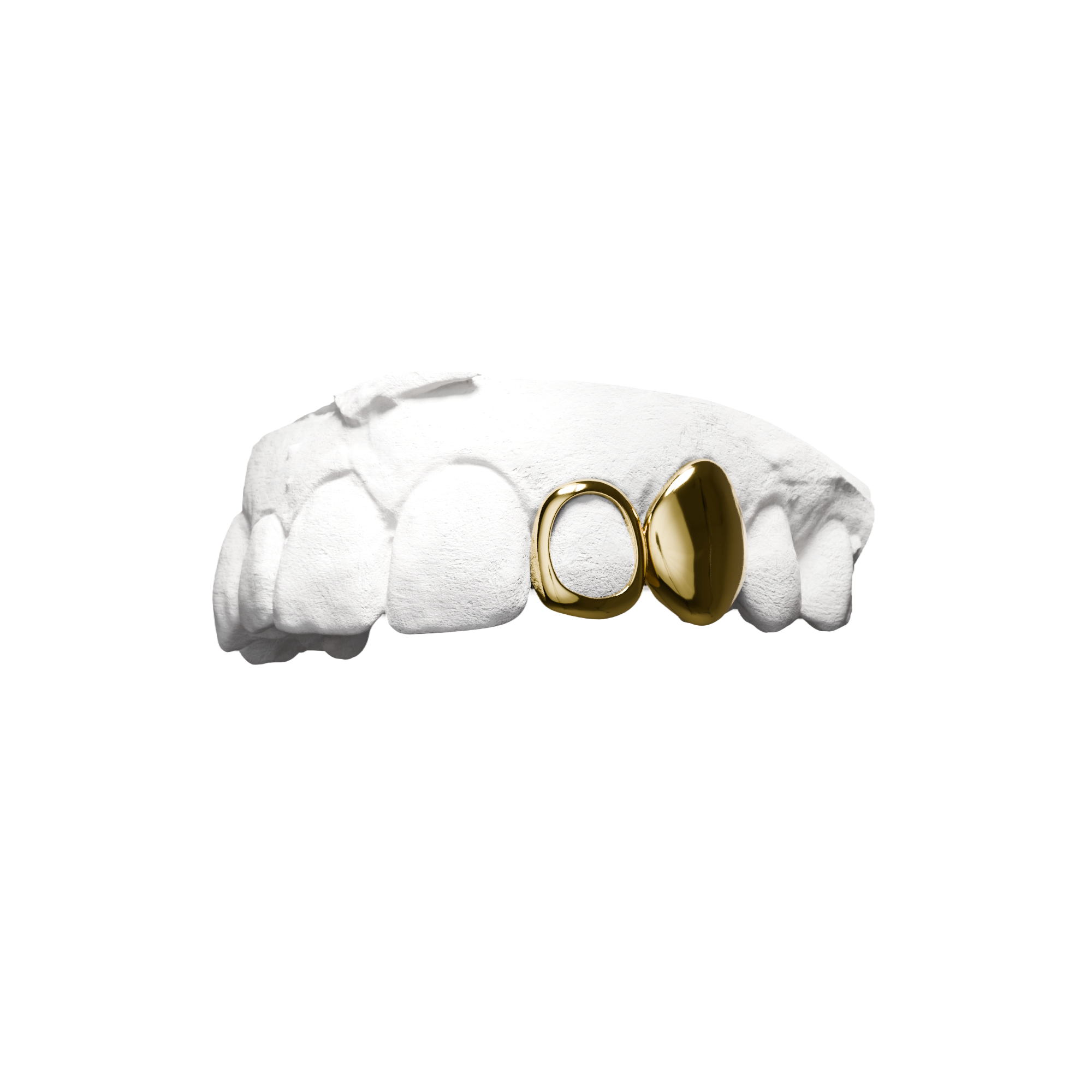 Grillz Pleine Fenêtre – dent pleine sur canine et fenêtre sur latérale, or, vue 3/4