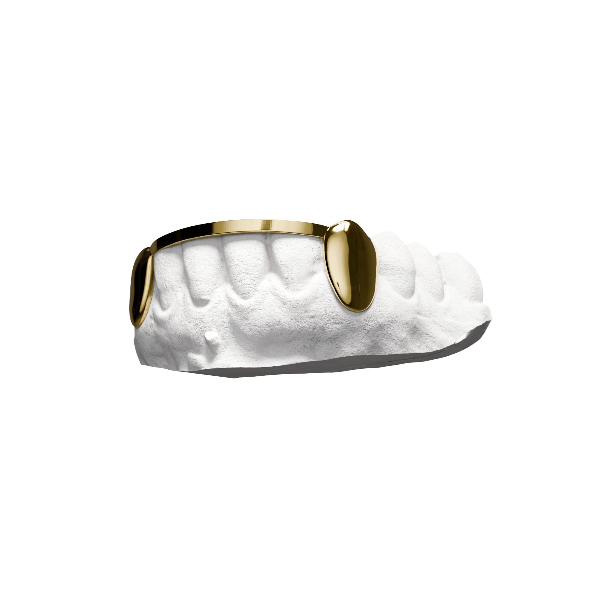 Grillz Solid London Bridge – deux pleines canines reliées par une barre, or, vue 3/4
