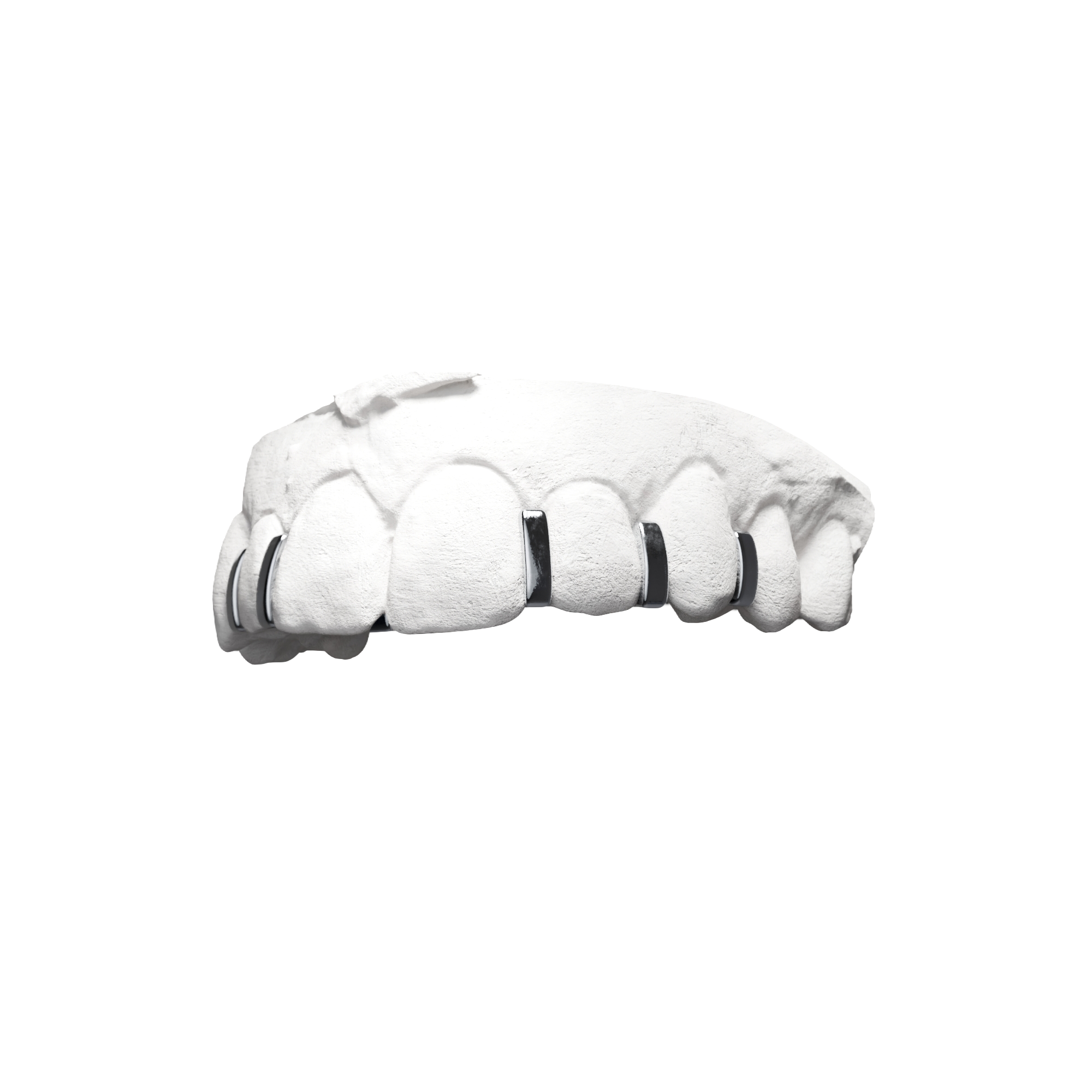 Grillz X6 Interstices – six interstices répartis sur la dentition, argent, vue 3/4